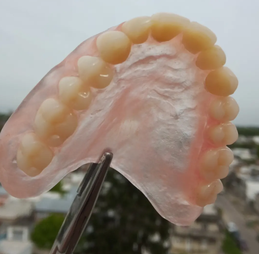 Prótesis dental superior completa terminada