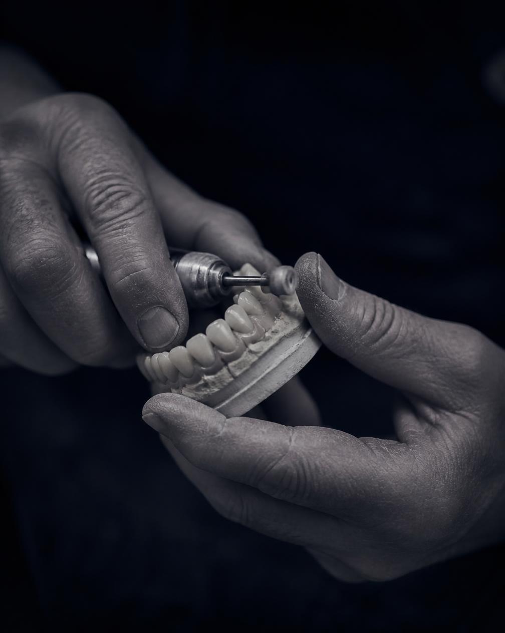 Manos de un técnico dental con experiencia trabajando una prótesis